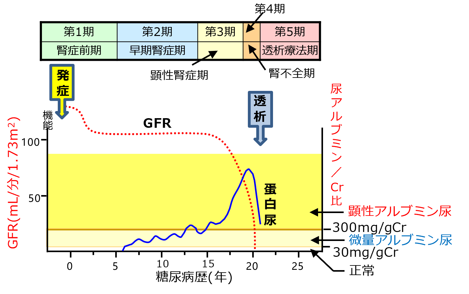 24 時間尿量検査の準備はどのようにすればよいですか?