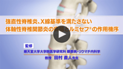 強直性脊椎炎、X線基準を満たさない体軸性脊椎関節炎の病態とルミセフ®の作用機序