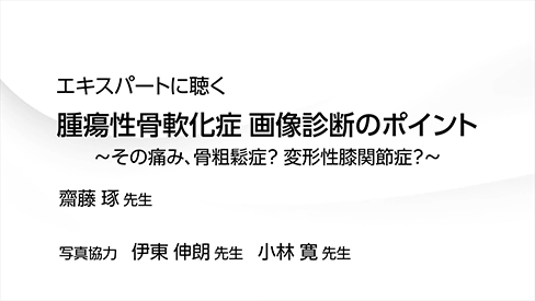 動画「エキスパートに聴く　腫瘍性骨軟化症 画像診断のポイント ～その痛み、骨粗鬆症？ 変形性膝関節症？～」（5分54秒）公開 のサムネイル画像