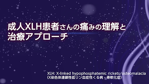 動画「成人XLH患者さんの痛みの理解と治療アプローチ」（2分33秒）公開 のサムネイル画像