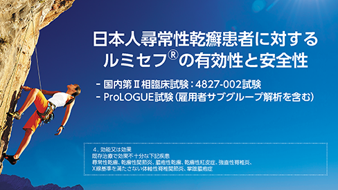 「国内臨床試験成績とProLOGUE試験（雇用者サブグループ解析を含む)」公開 のサムネイル画像