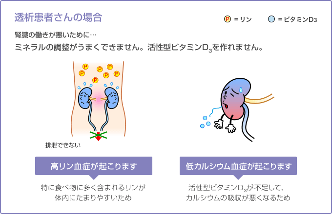 医師は二次性凝固亢進状態をどのように診断するのでしょうか?